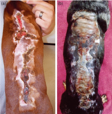 thermal injury garden hose scalding syndrome thermal injury