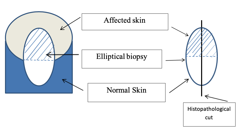 Skin Punch Biopsy An Overview For The Veterinary Nurse skin-punch-biopsy-an-overview-for-the-veterinary-nurse