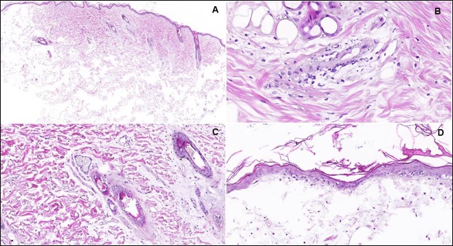 Schematic of Indirect Fluorescent Antibody Detection of Canine Serum ANA Titers