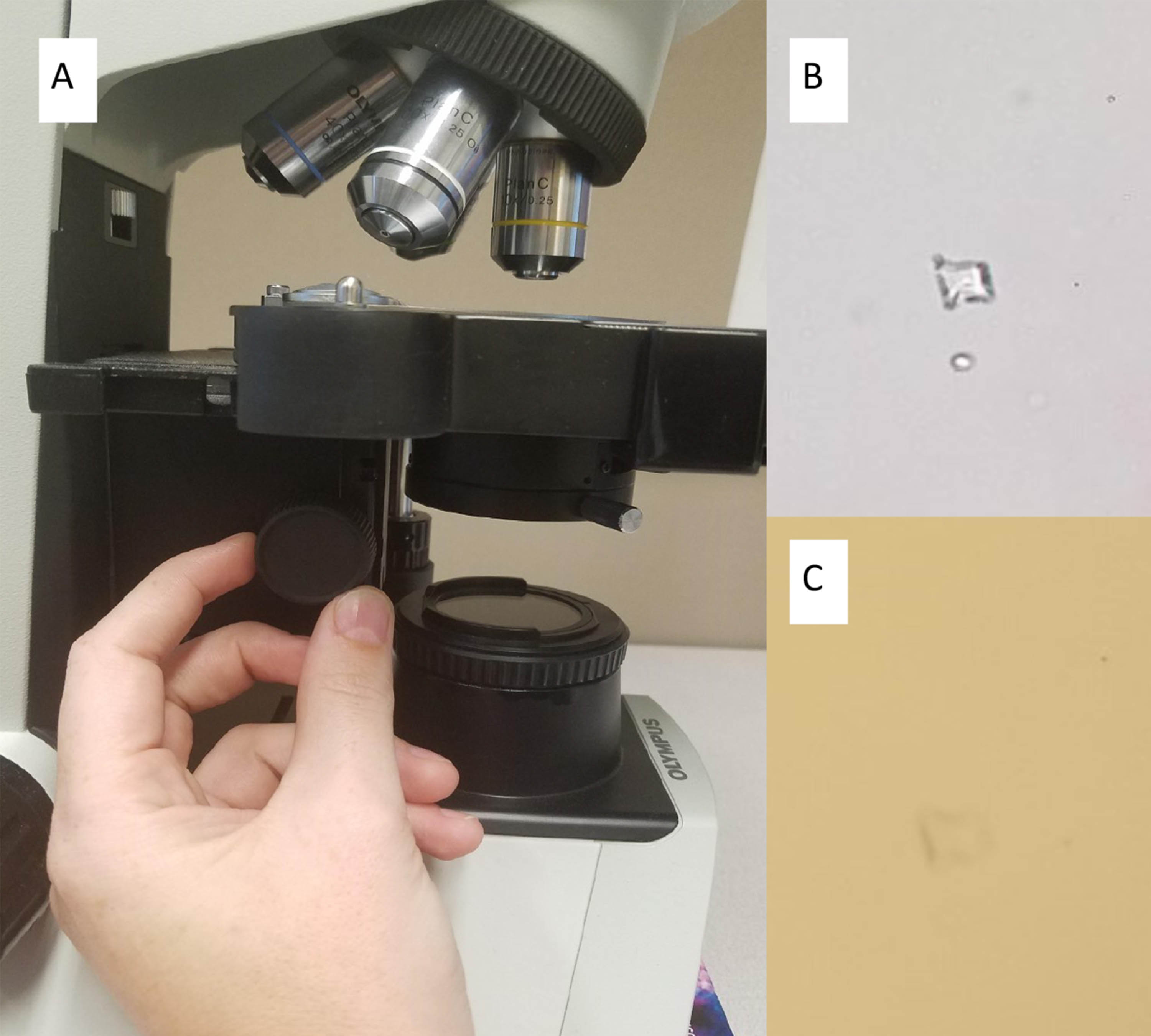 urinalysis image