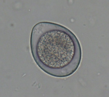 Cystoisospora