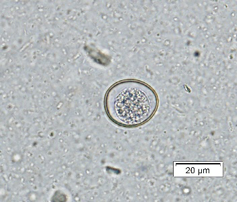 Cystoisospora