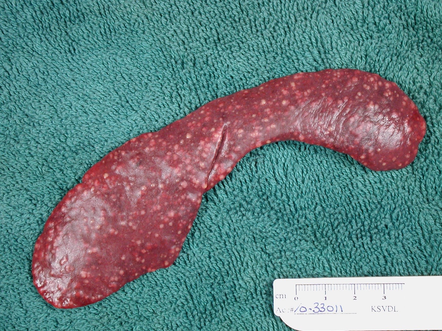 Figure 1 spleen