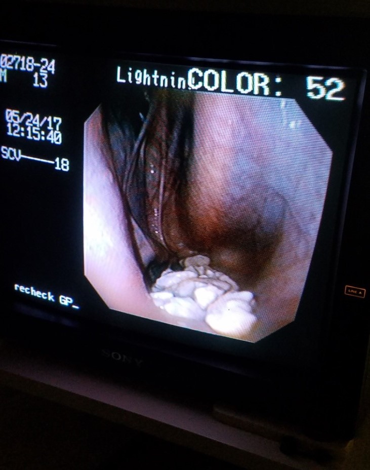 Scope photo